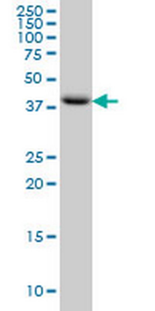 MGC13096 Antibody in Western Blot (WB)