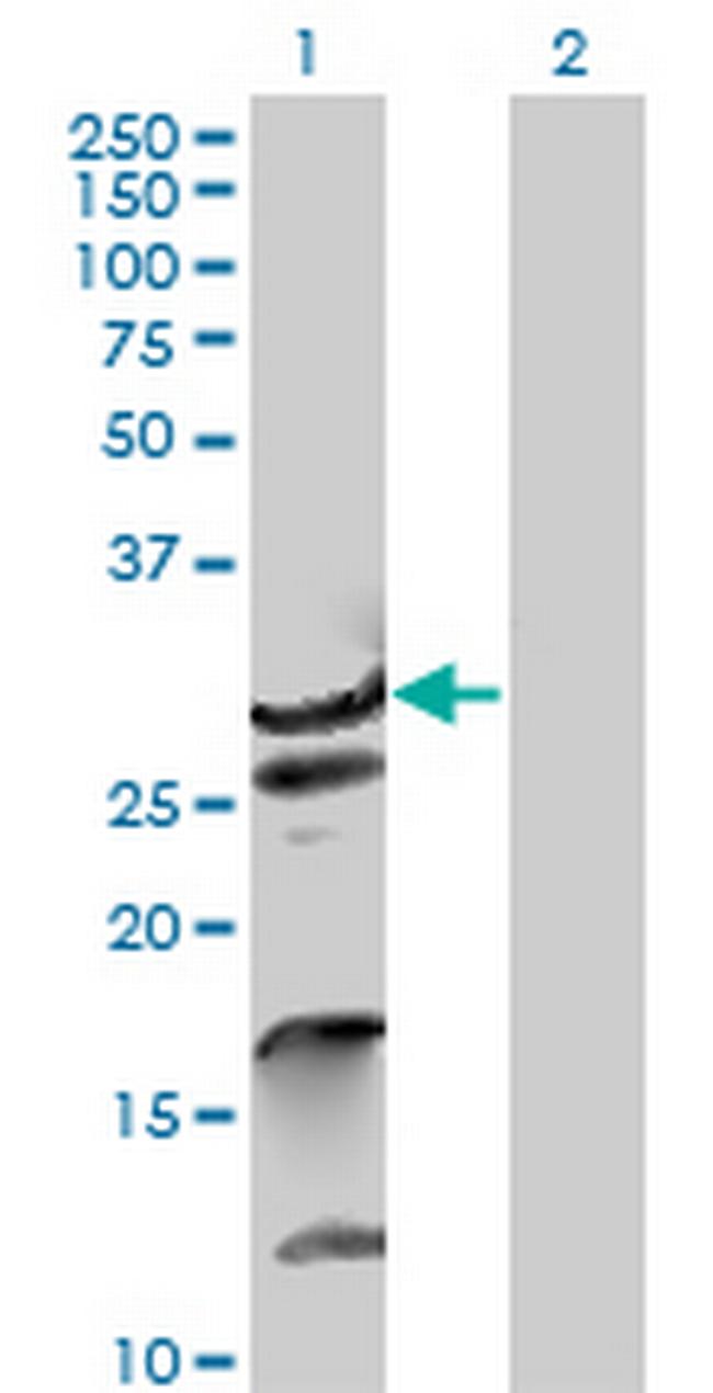 ZNF397 Antibody in Western Blot (WB)