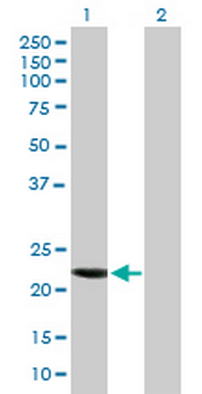 CCDC115 Antibody in Western Blot (WB)