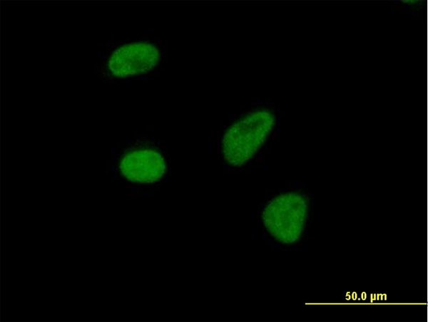 THOC3 Antibody in Immunocytochemistry (ICC/IF)