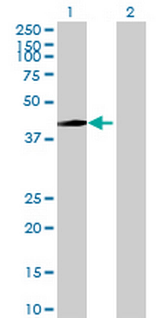 THOC3 Antibody in Western Blot (WB)