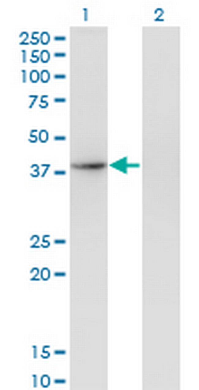 THOC3 Antibody in Western Blot (WB)