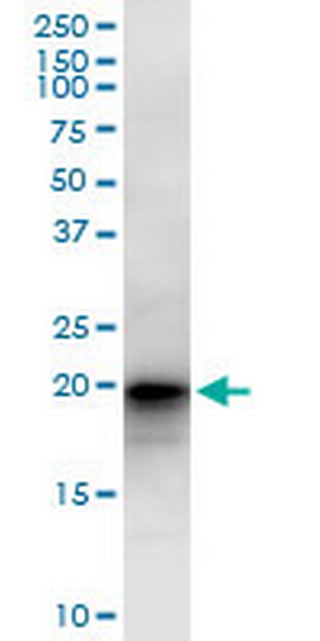 LZIC Antibody in Western Blot (WB)