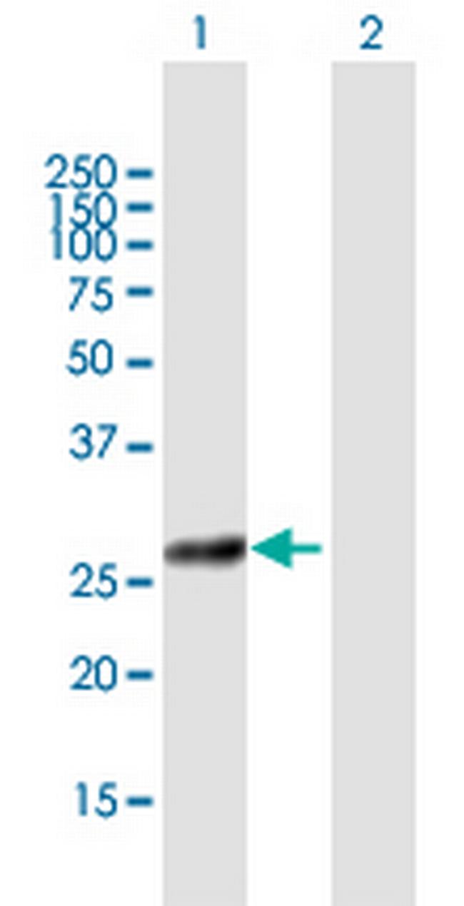 COG8 Antibody in Western Blot (WB)