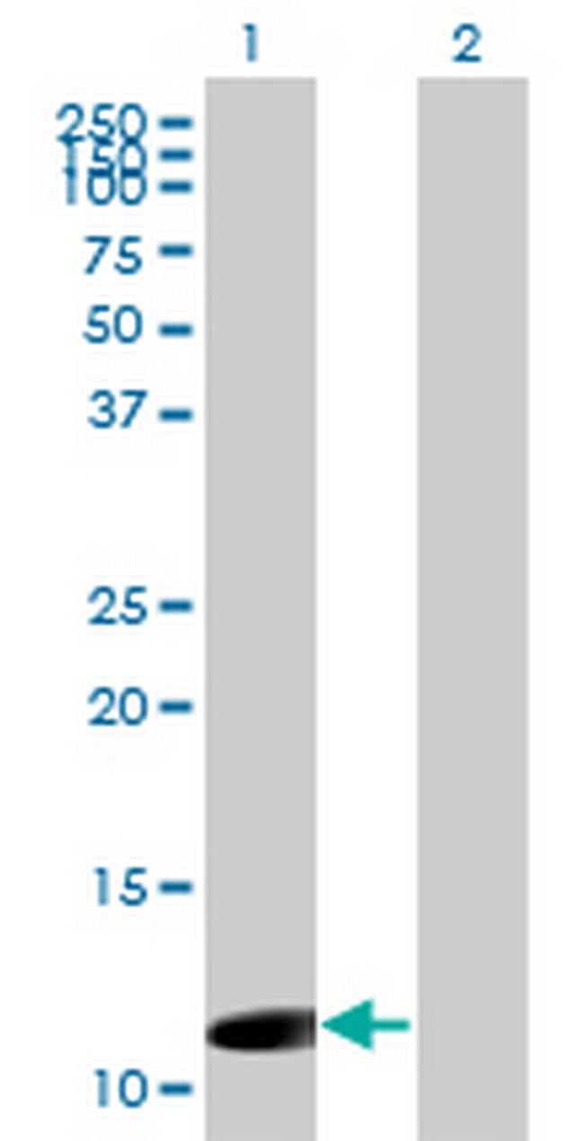 ORF1-FL49 Antibody in Western Blot (WB)