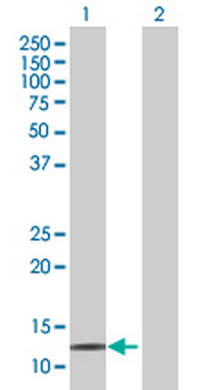 HOP Antibody in Western Blot (WB)