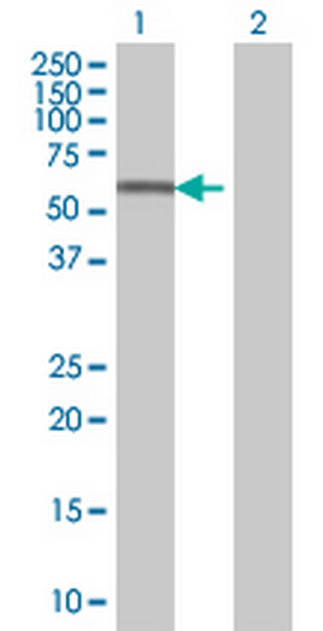 ZNF559 Antibody in Western Blot (WB)