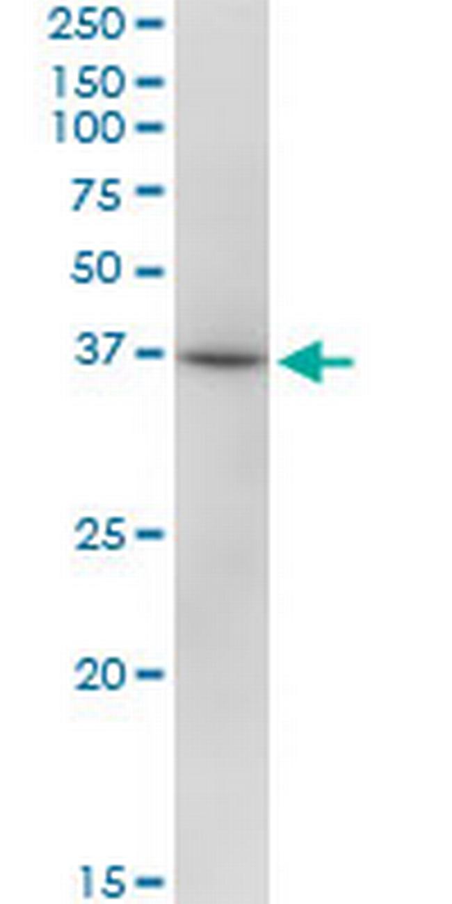 RHOXF2 Antibody in Western Blot (WB)