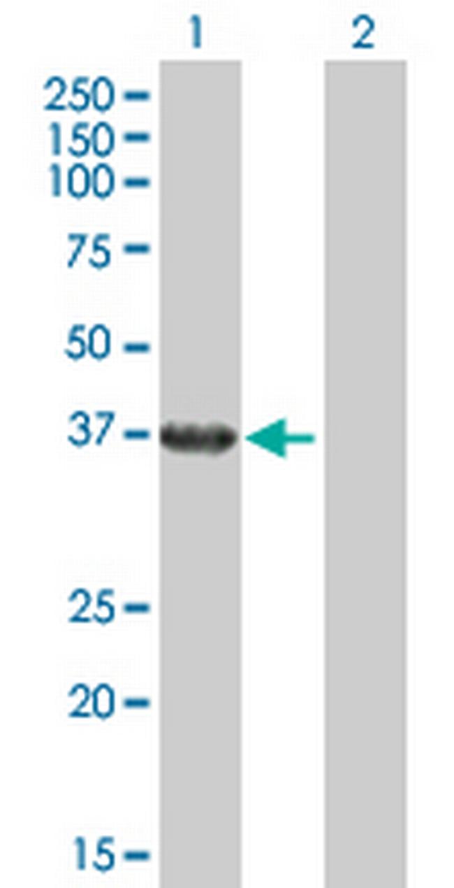 RHOXF2 Antibody in Western Blot (WB)