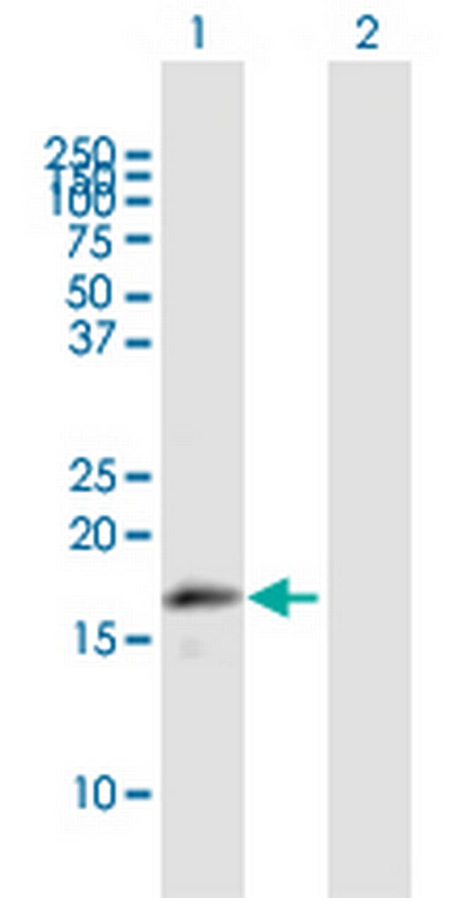 MRPL43 Antibody in Western Blot (WB)