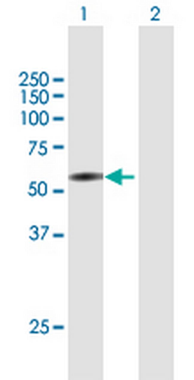 COL25A1 Antibody in Western Blot (WB)