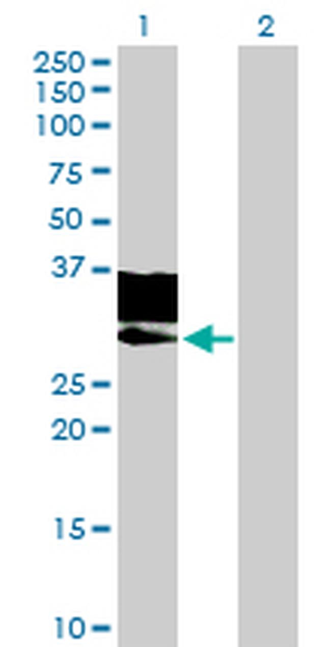 GNPTG Antibody in Western Blot (WB)
