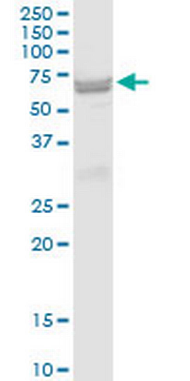 ST6GAL2 Antibody in Western Blot (WB)