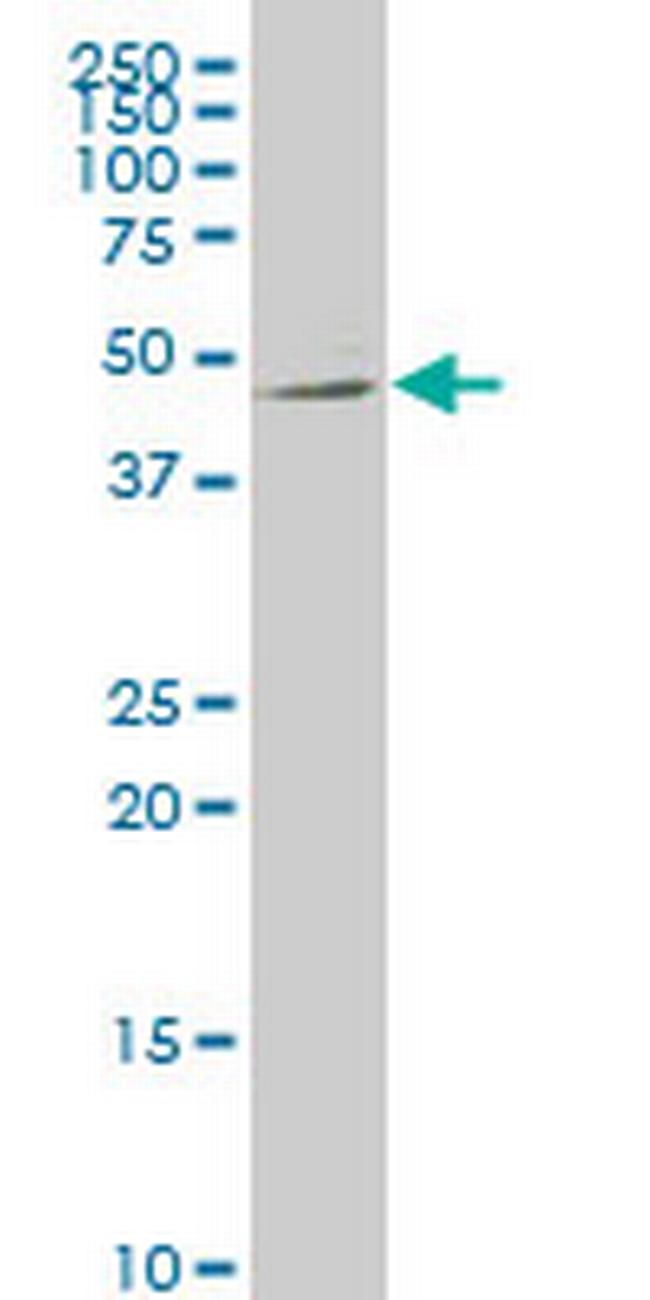 NTNG2 Antibody in Western Blot (WB)