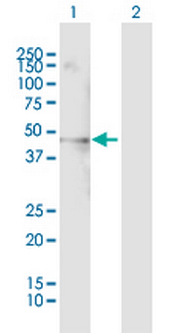 PSRC1 Antibody in Western Blot (WB)