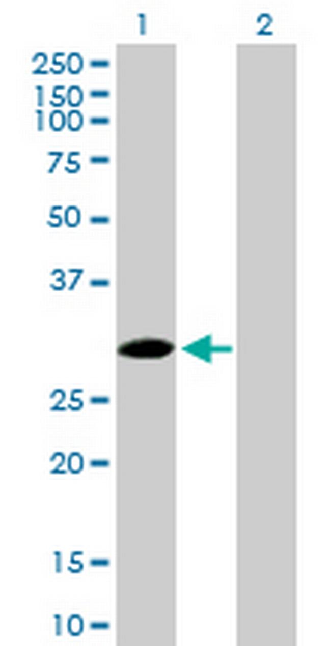 SPSB2 Antibody in Western Blot (WB)