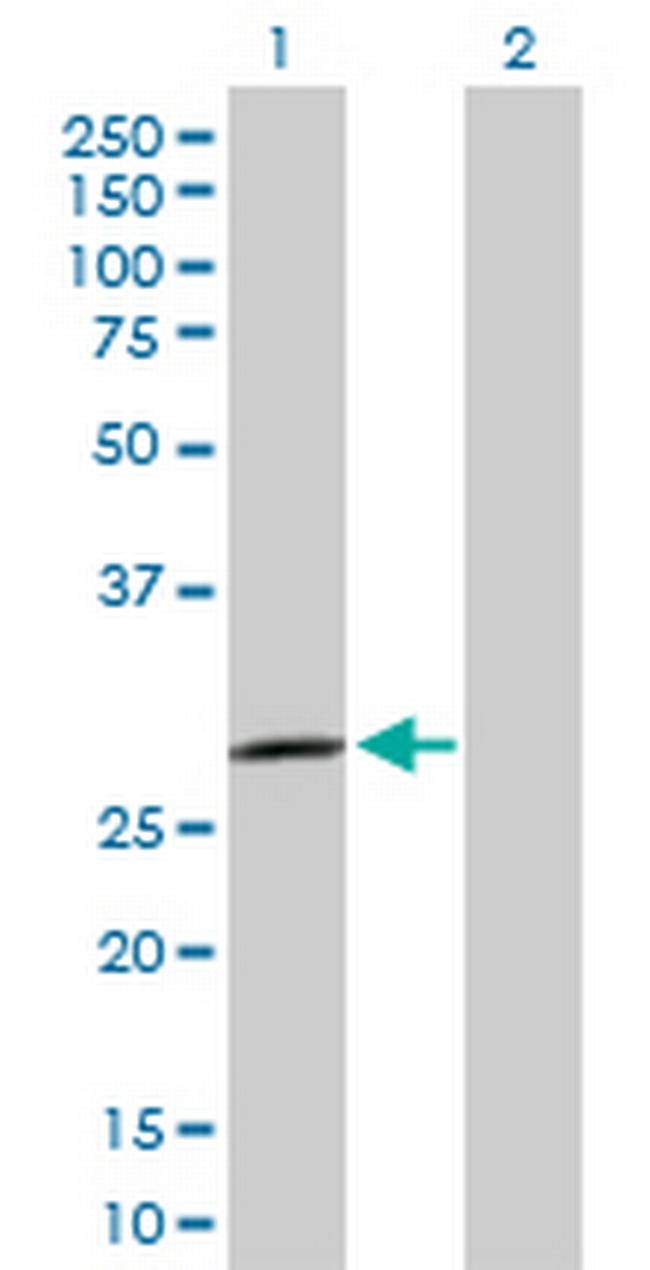 SPSB2 Antibody in Western Blot (WB)