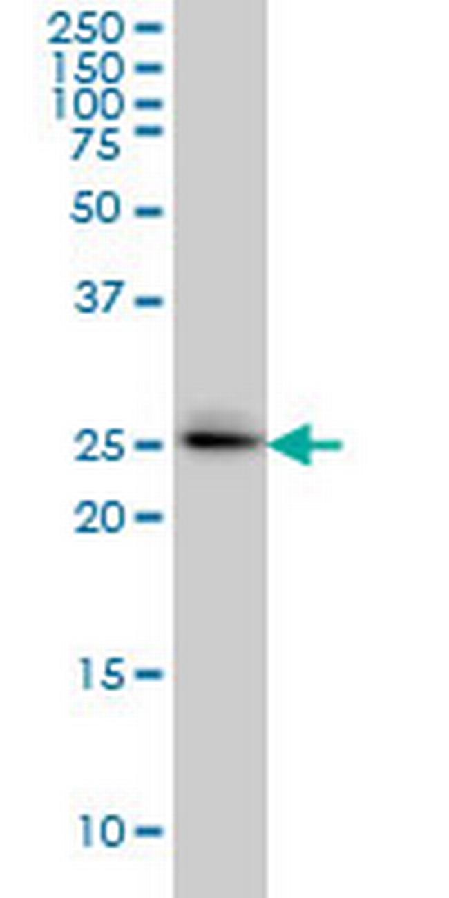 GRCC9 Antibody in Western Blot (WB)