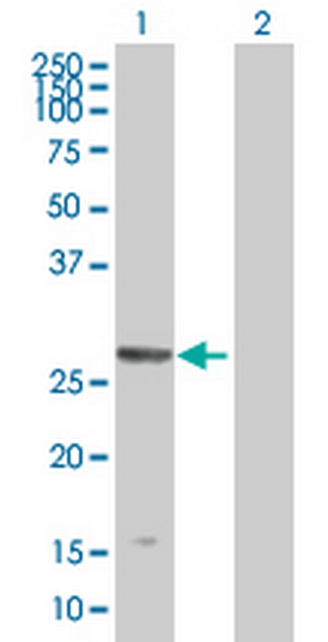 TRIM51 Antibody in Western Blot (WB)