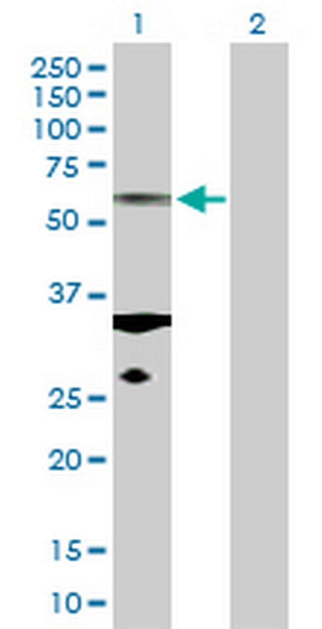 TUBA1C Antibody in Western Blot (WB)