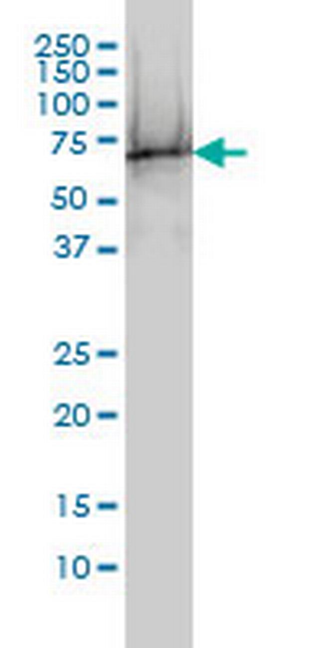 TUBA6 Antibody in Western Blot (WB)