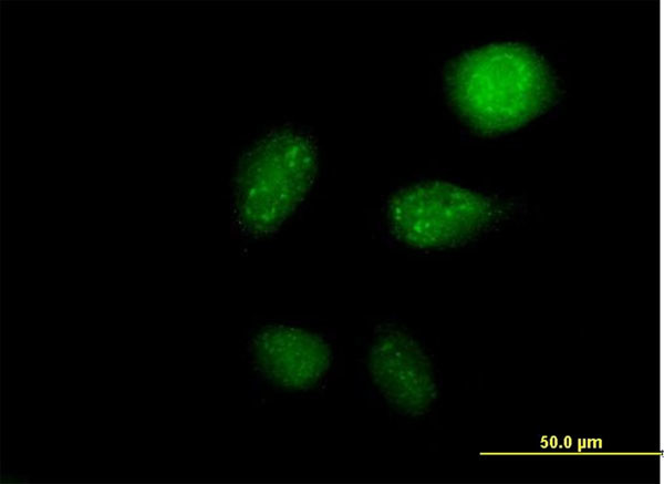 PLCD4 Antibody in Immunocytochemistry (ICC/IF)