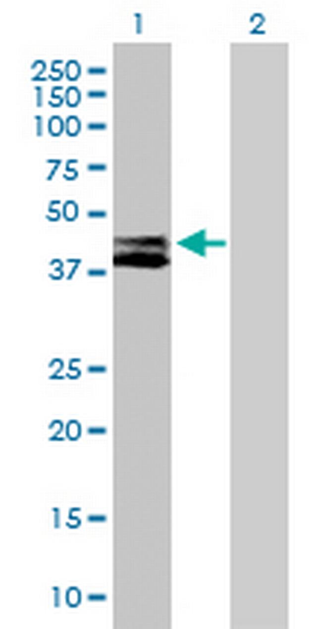 RTN4IP1 Antibody in Western Blot (WB)