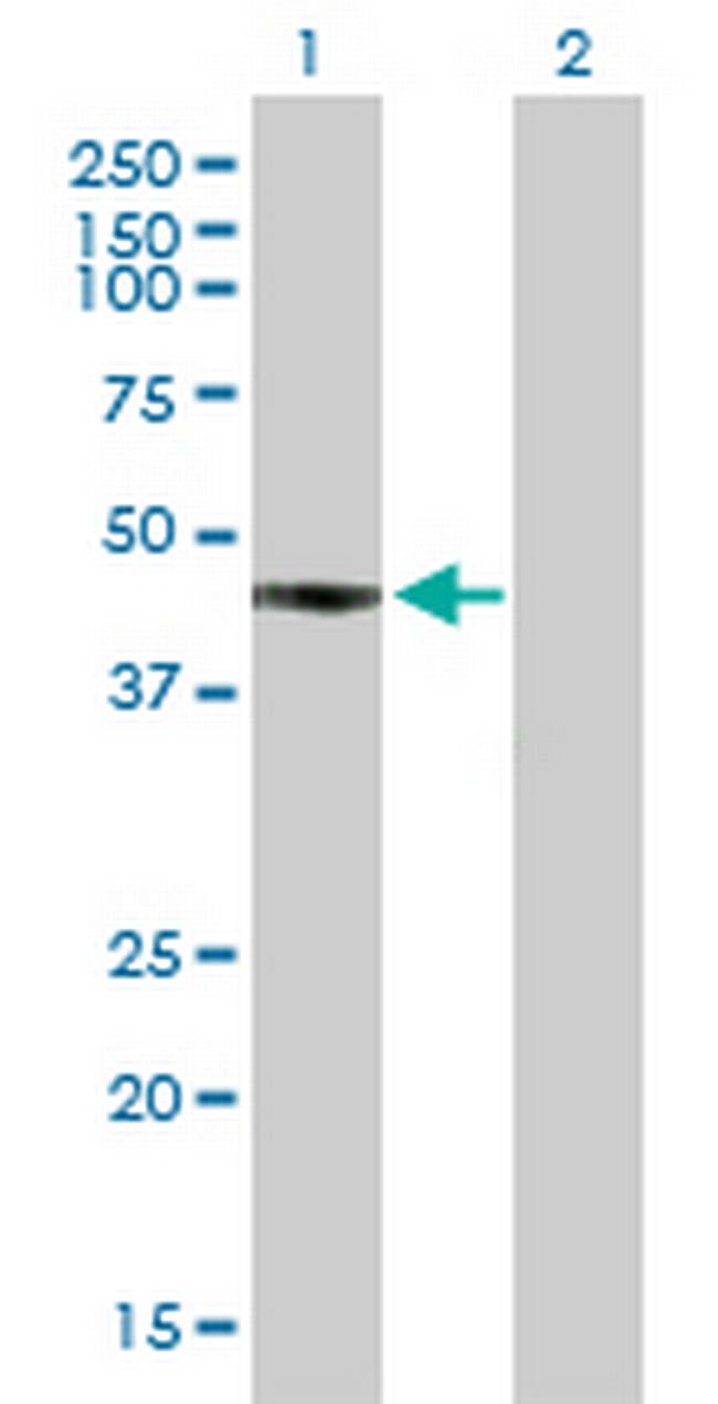 FCRLA Antibody in Western Blot (WB)