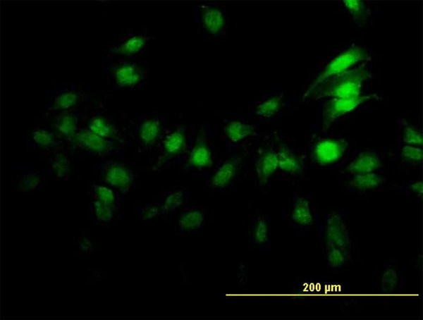 ZNF496 Antibody in Immunocytochemistry (ICC/IF)