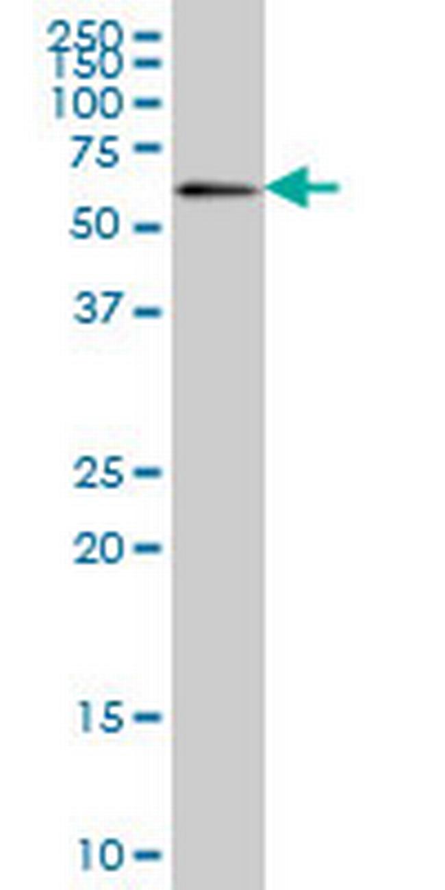 ZNF496 Antibody in Western Blot (WB)