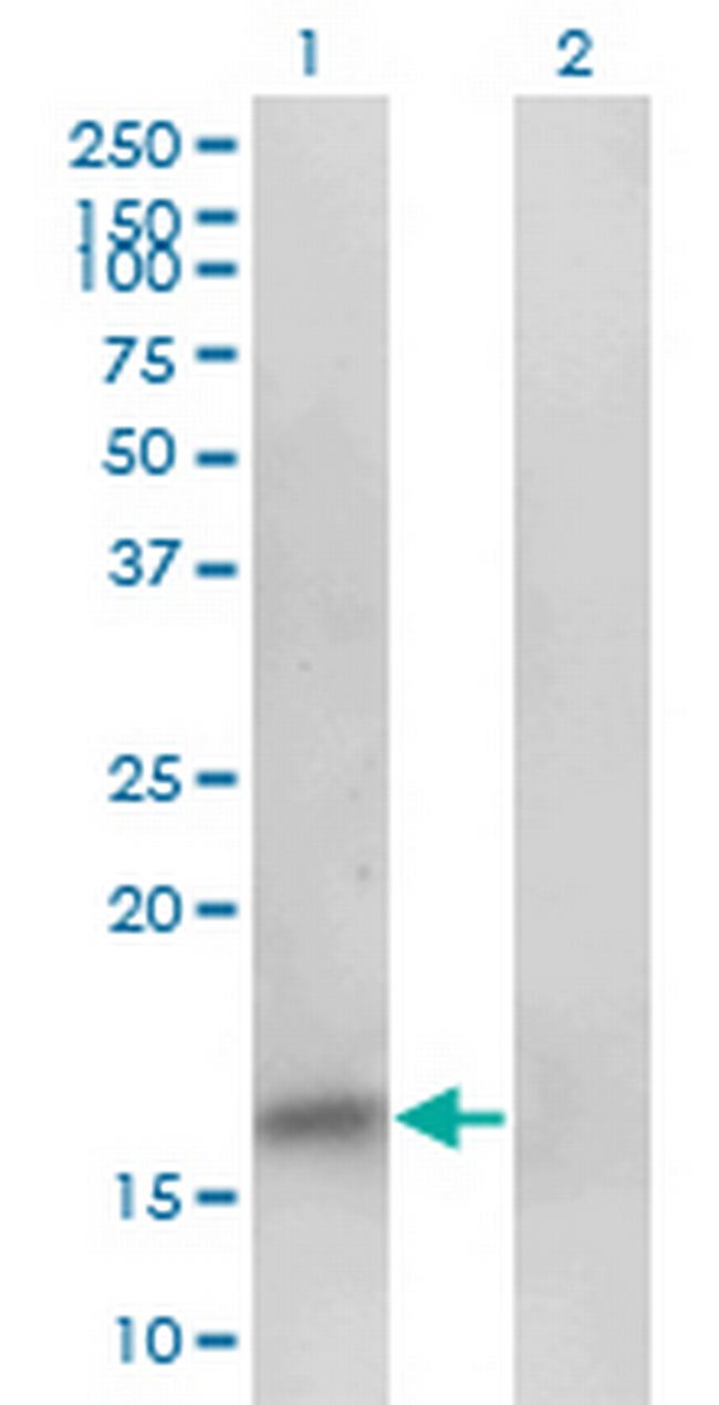 PHF5A Antibody in Western Blot (WB)