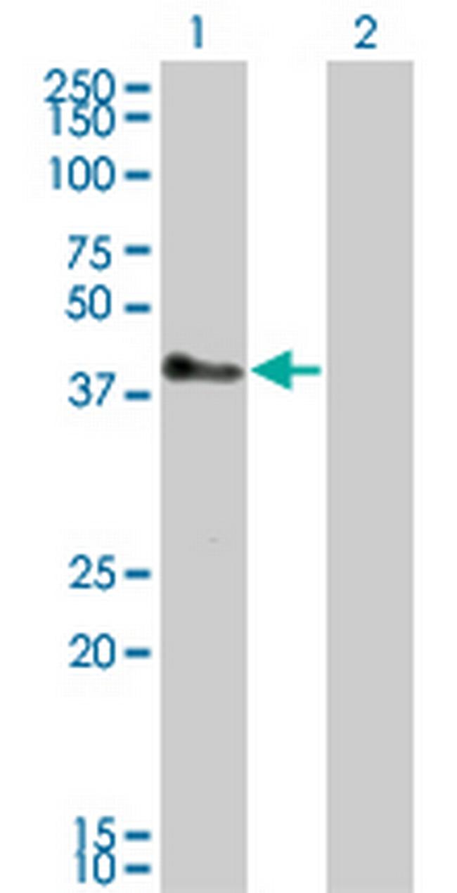 TRIM52 Antibody in Western Blot (WB)