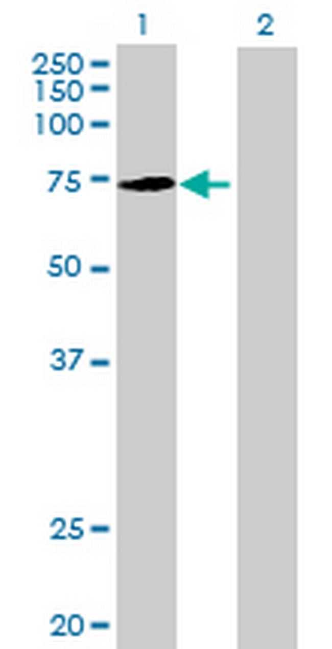 KLHL22 Antibody in Western Blot (WB)