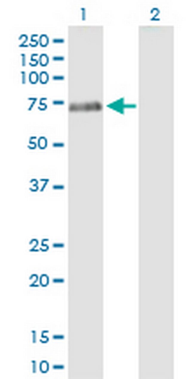 PTPN5 Antibody in Western Blot (WB)
