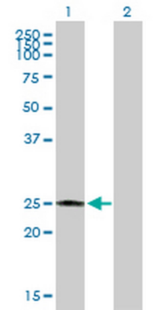 CBR4 Antibody in Western Blot (WB)