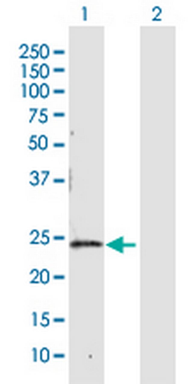 CBR4 Antibody in Western Blot (WB)