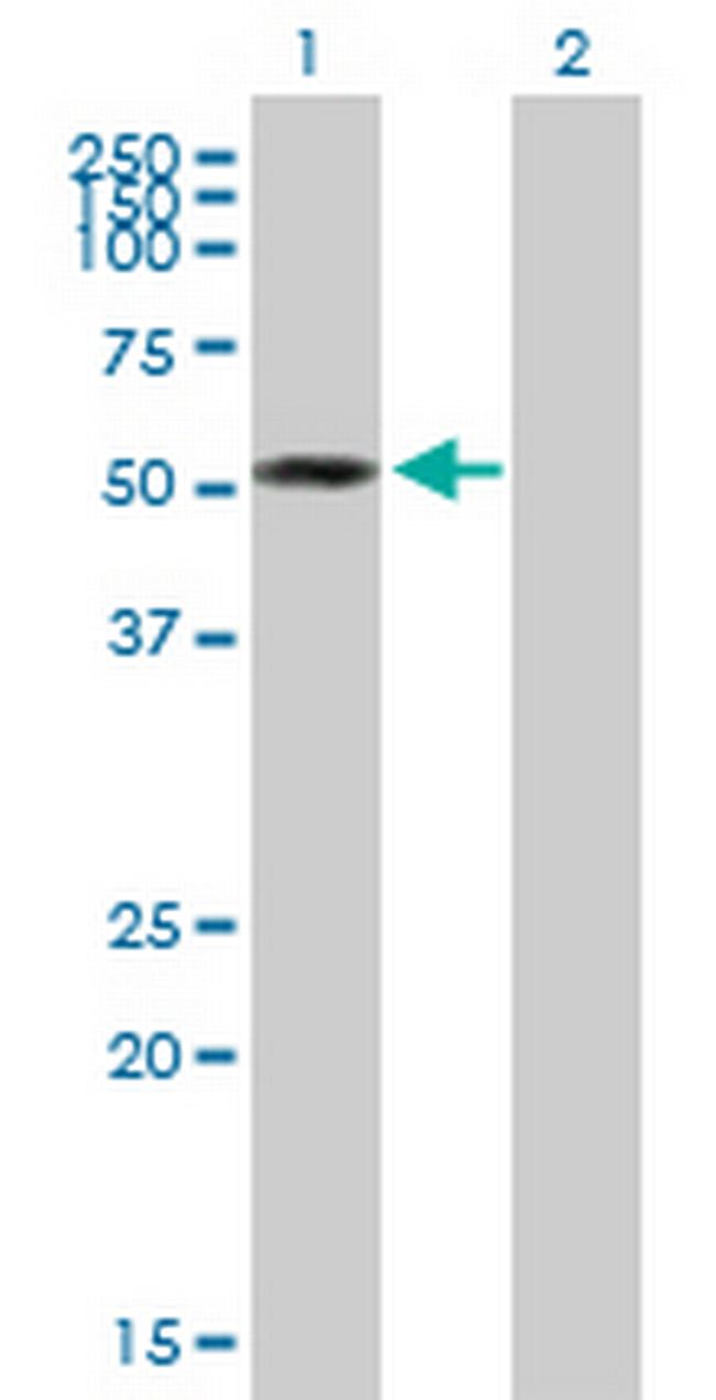ZC3H10 Antibody in Western Blot (WB)