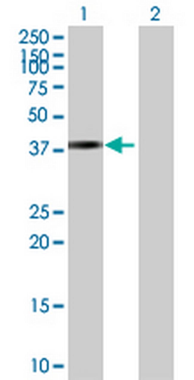ZNF514 Antibody in Western Blot (WB)