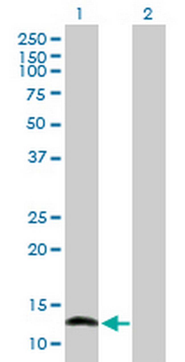 NFATC2IP Antibody in Western Blot (WB)