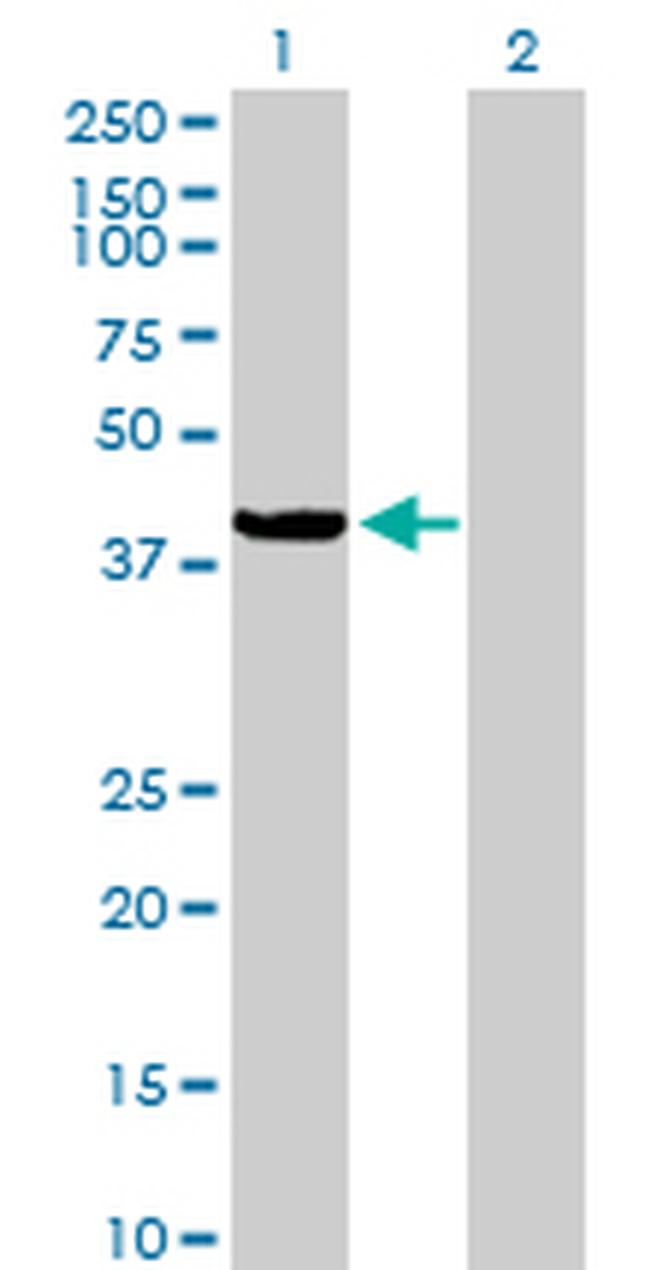 C9ORF100 Antibody in Western Blot (WB)