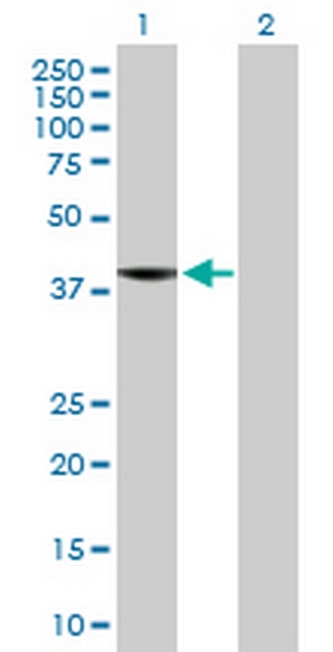 C8orf76 Antibody in Western Blot (WB)
