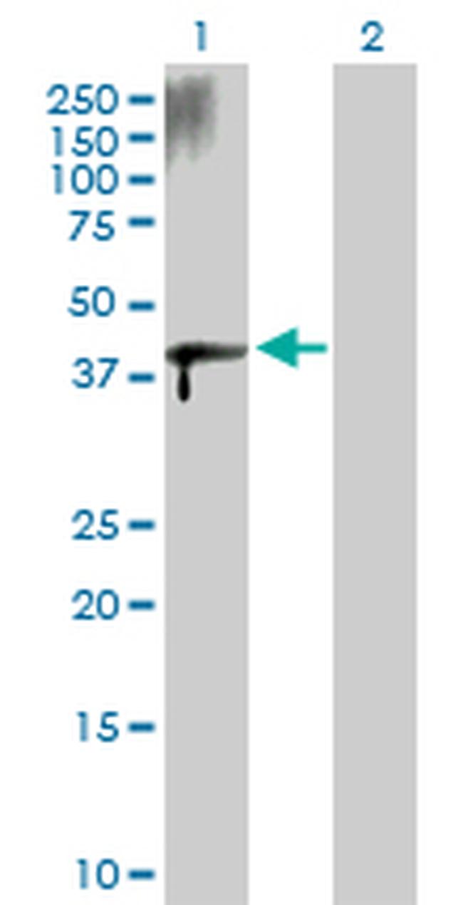 ZFYVE19 Antibody in Western Blot (WB)