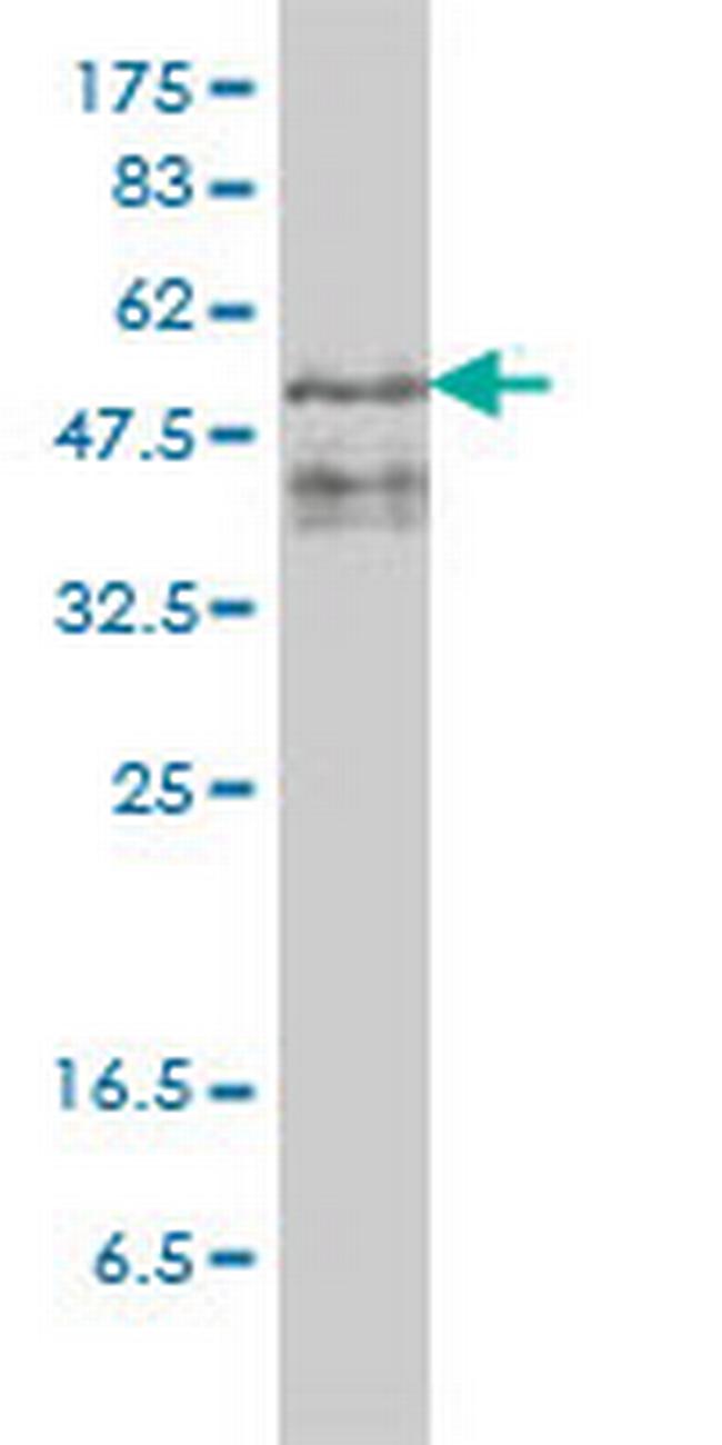 ZFYVE19 Antibody in Western Blot (WB)