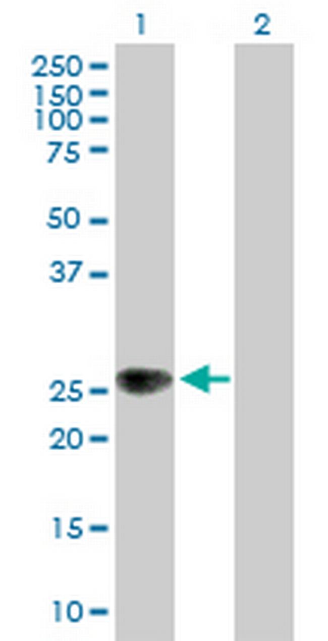 ZNRF1 Antibody in Western Blot (WB)
