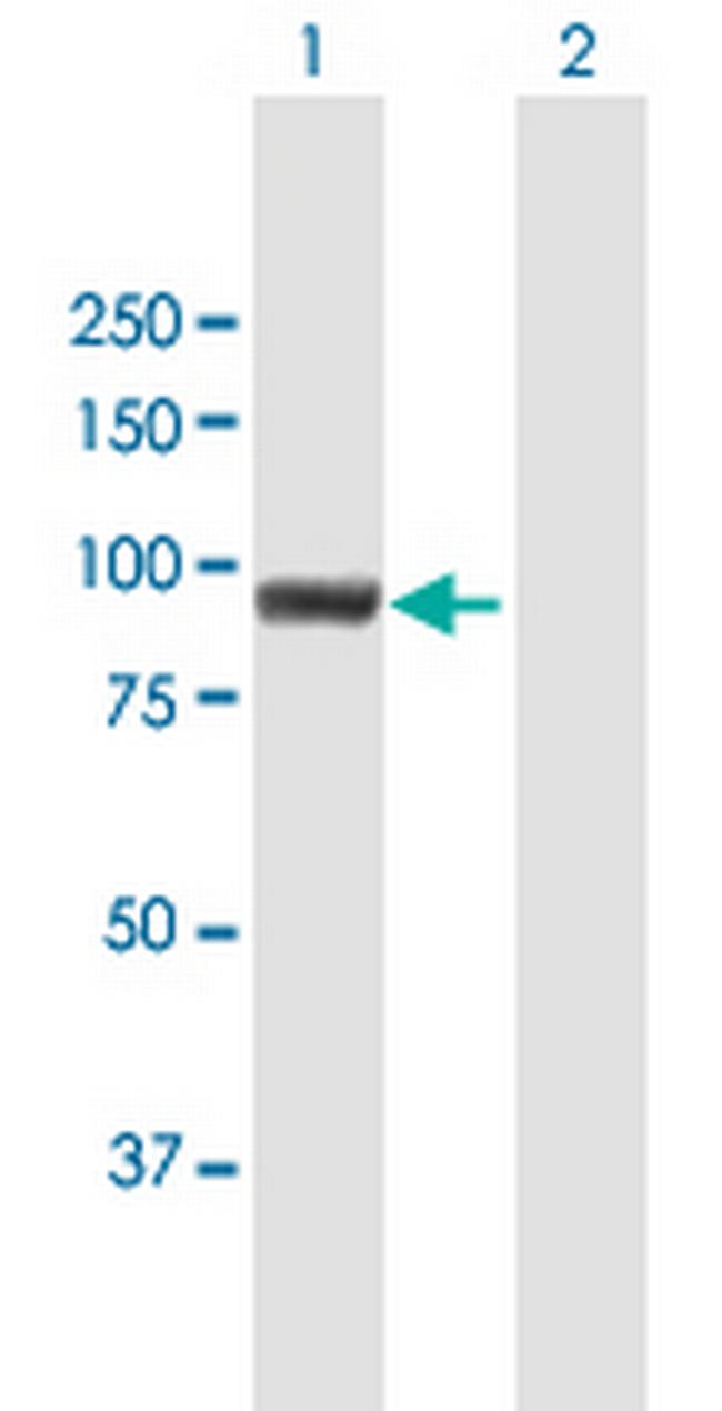 MUM1 Antibody in Western Blot (WB)