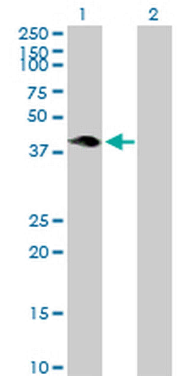 HSH2D Antibody in Western Blot (WB)