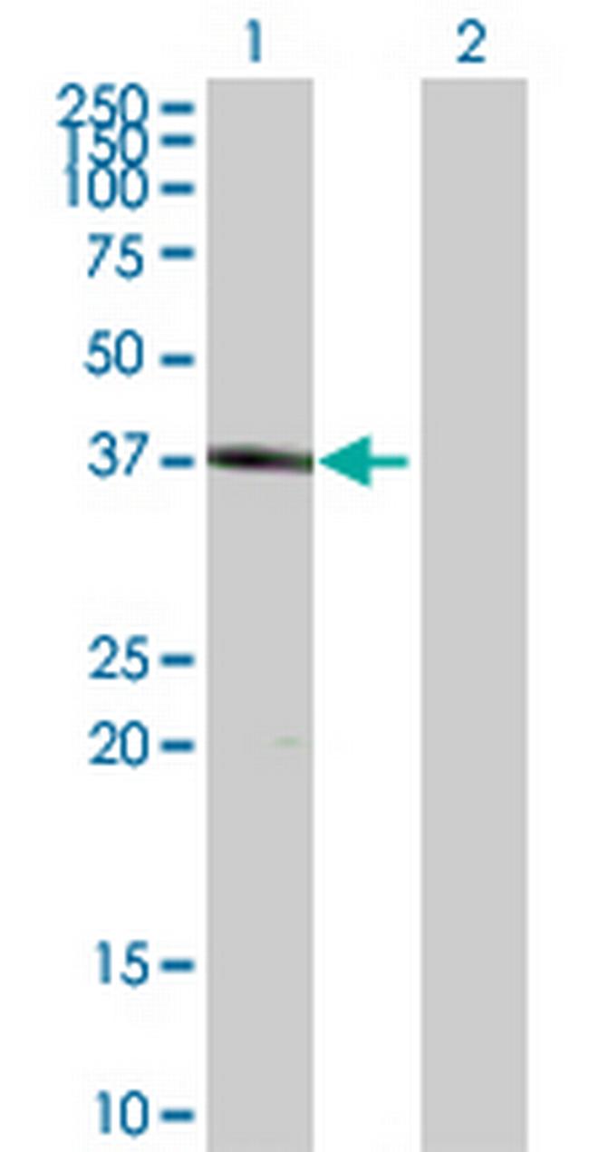HSH2D Antibody in Western Blot (WB)