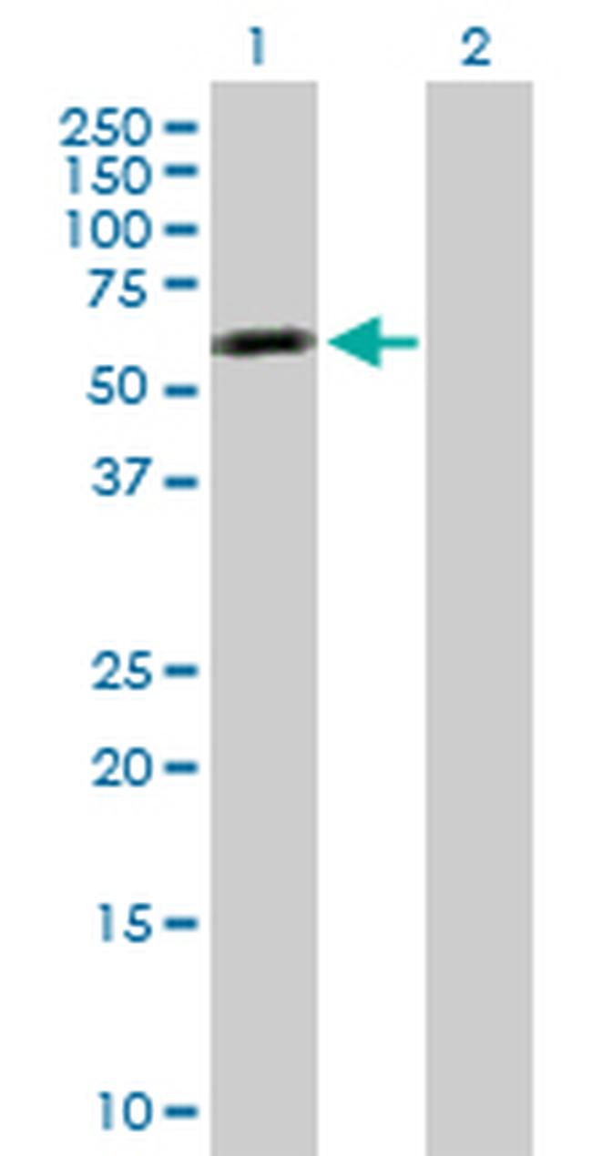 TNS4 Antibody in Western Blot (WB)
