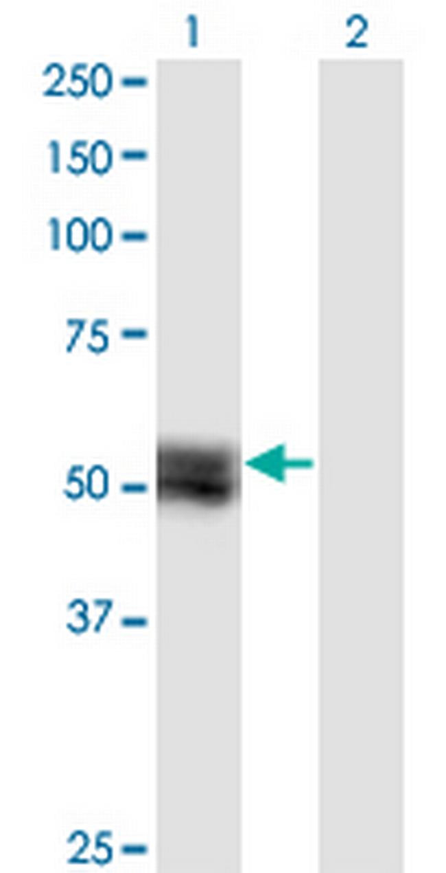 TNS4 Antibody in Western Blot (WB)