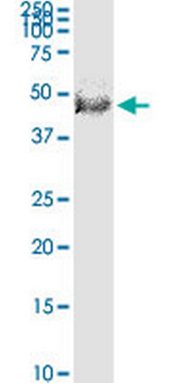 FBXL20 Antibody in Western Blot (WB)